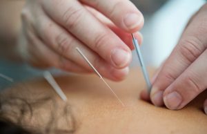 Acupuncture in Sheffield